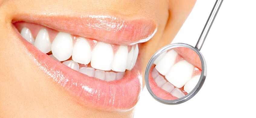 Отбеливание зубов в клинике 